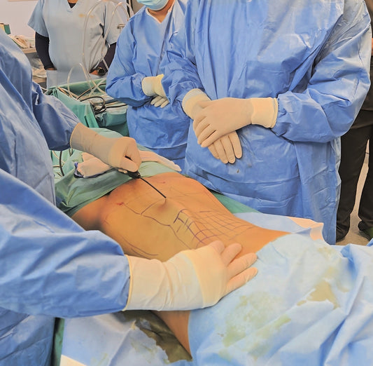 surgeon holding ignite RF handpiece during body contouring surgery